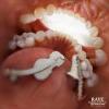 Raye - Escapism+%28Devolve+Remix%29